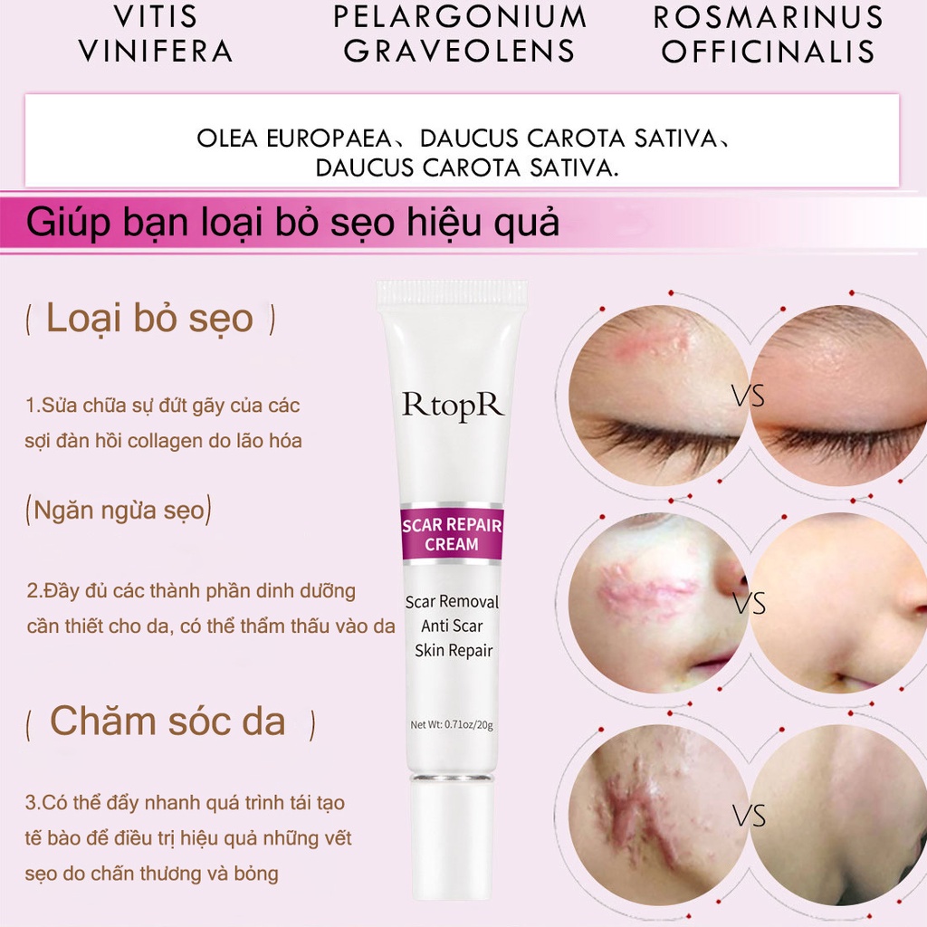 Kem xóa sẹo RtopR mango scar repair cream 15g Xóa và sửa sẹo trên mặt， cơ thể, vết bỏng ở trẻ em,  phụ nữ sau sinh mổ