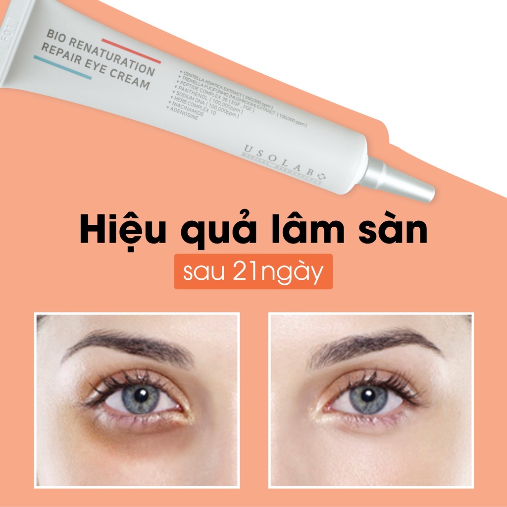 Kem mắt Repair Eye Cream USOLAB - Giúp dưỡng mắt,mờ thâm,dưỡng ẩm,tan bọng mắt tăng độ đàn hồi săn chắc giúp da 30ml