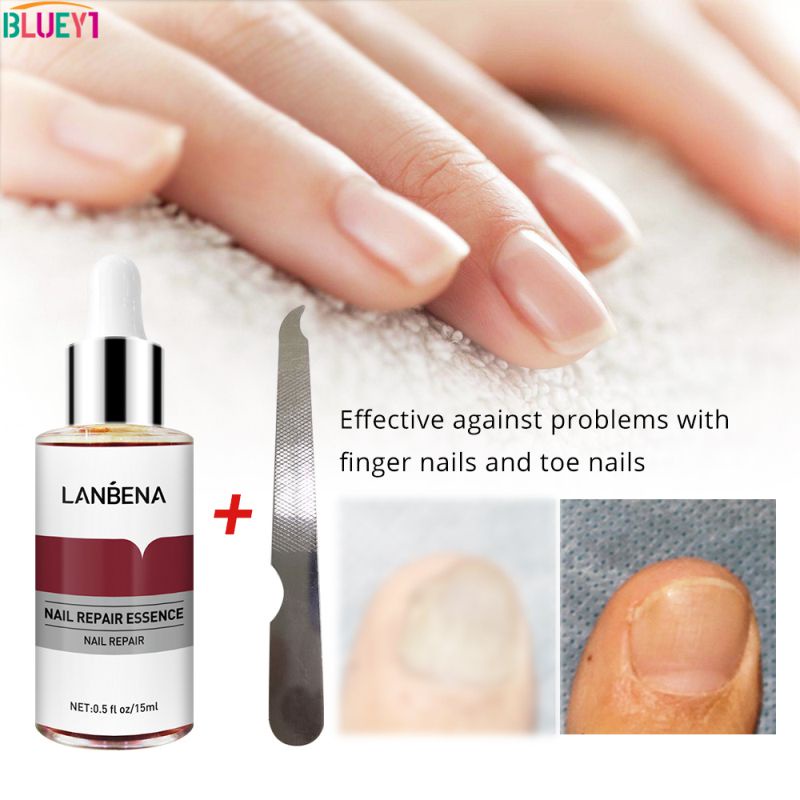 Lanbena Tinh Chất Phục Hồi Móng Huyết Thanh Trị Nấm Móng Loại Bỏ Nấm Móng Chân Nuôi Dưỡng Làm Sáng Da Tay Chân 15Ml Bluey1