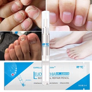 Bút Thảo Dược Trị Bệnh Nấm Móng Chăm Sóc Móng
