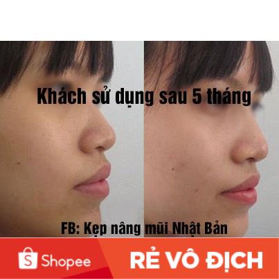 Tinh dầu nâng mũi tặng kẹp nâng mũi