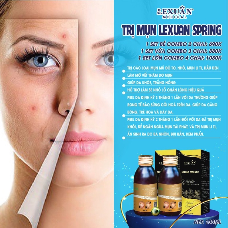 Sạch Mụn Thâm Lê Xuân Cosmetic 130ml Sạch Mụn Trứng Cá Mụn Ẩn Mụn Đầu Đen Tinh chất ngừa mụn Lê Xuân hiệu quả sau 2 tuần