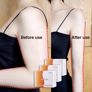 Miếng Dán Tan Mỡ Bụng Giảm Cân Nhanh Chóng