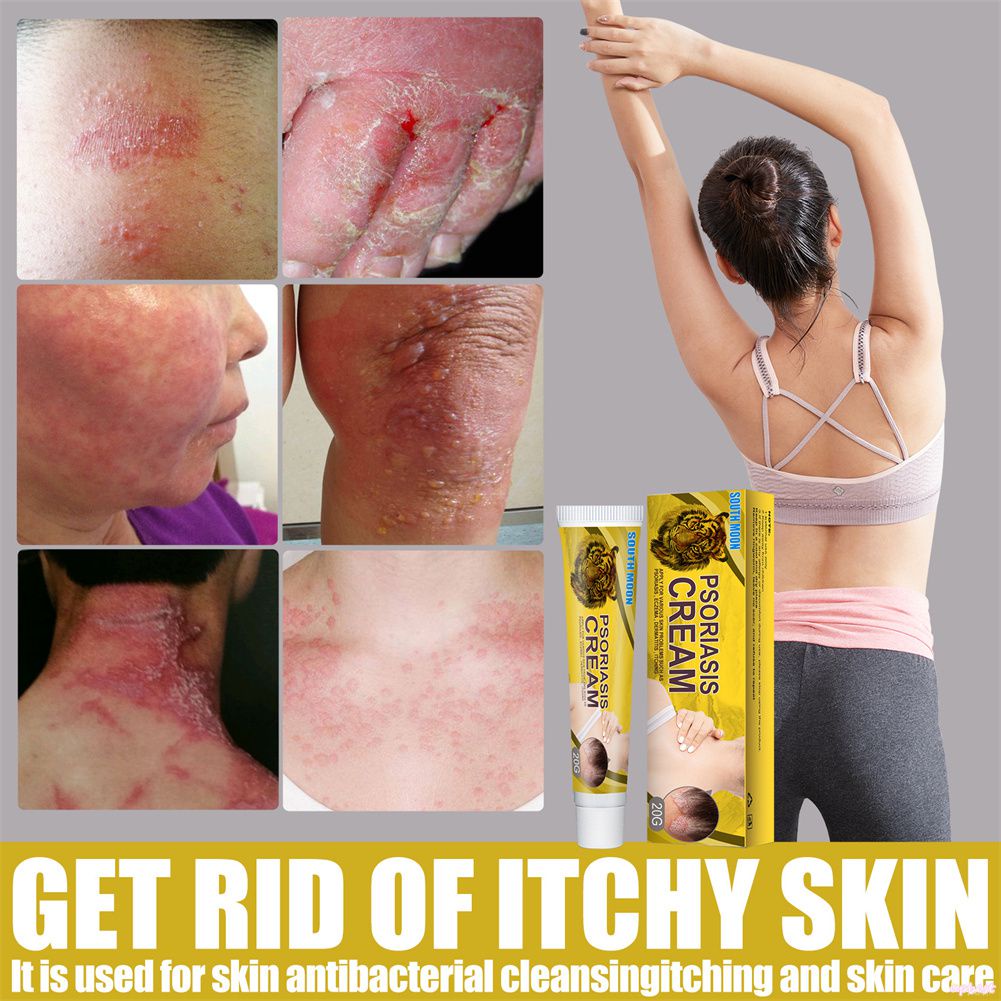 ♕Kem Vẩy Nến South Moon Thuốc Mỡ Bôi Ngoài Da Rêu Mồ Hôi Kem Phục Hồi Da Thực Vật Tự Nhiên Chống Ngứa Chăm Sóc Cơ Thể 24G Upbest
