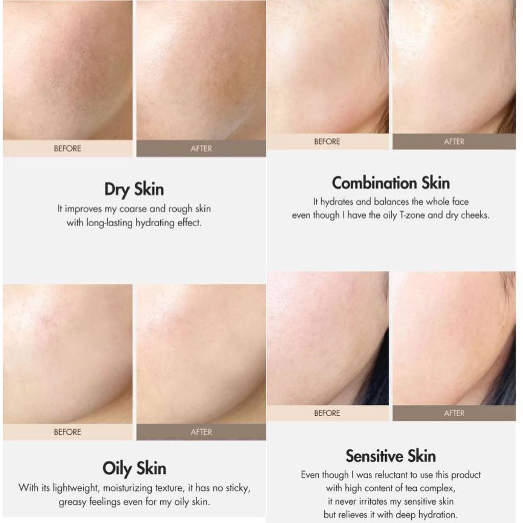 Kem dưỡng ẩm làm sáng da, chống lão hóa thuần chay Dr.Ceuracle Vegan Kombucha Tea Gel Cream 75g