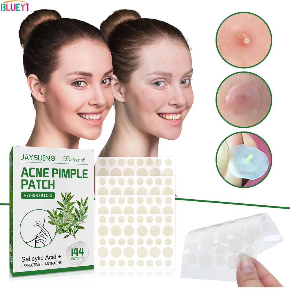 144 Miếng Dán Trị Mụn Miếng Dán Trị Mụn Hydrocolloid Miếng Che Khuyết Điểm Trong Suốt Không Thấm Nước Tàng Hình Loại Bỏ Mụn Bluey1