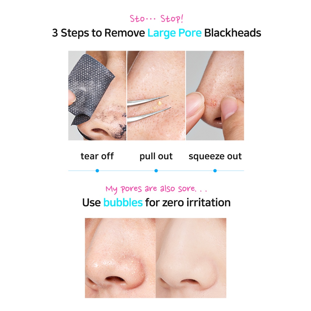 Set 5 Mặt Nạ Lột Mụn Đầu Đen Bong Bóng 3ml