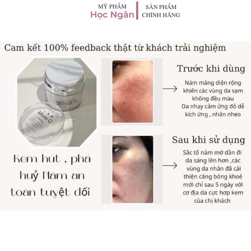 Kem dưỡng da Dr.MH Mela M Cream  Kem dưỡng Hàn Quốc, trắng da, chống não hóa