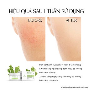 Kem làm mờ nám ban đêm Truesky chiết xuất tảo biển - Melasma Cream