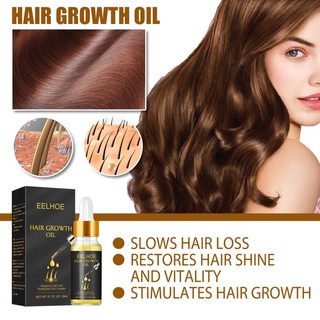 Tinh Dầu EELHOE Kích Thích Mọc Tóc Chống Rụng