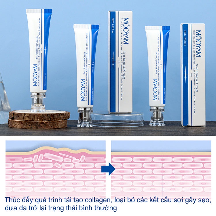 Kem xóa sẹo MOOYAM Scar removing cream 30g Trị sẹo lõm trị sẹo lâu năm