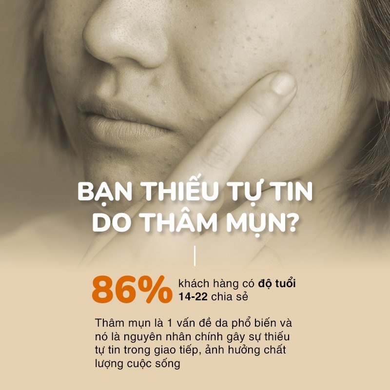 Gel Nghệ Giảm Mụn, Mờ Thâm Nano Curcumin Mờ Sẹo, Không Gây Vàng Da Dành Cho Da Dầu Mụn NEOSKIN 20gr