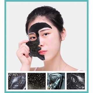 Lột mụn than tre hoạt tính có sẵn