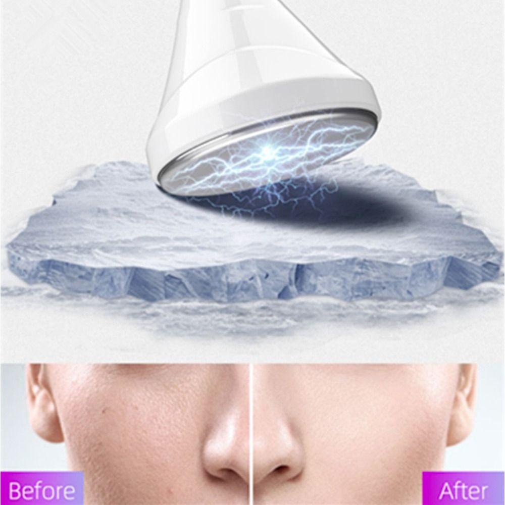 ANEMONE Máy Mát Xa Mắt Làm Mát Giúp Da Săn Chắc Se Khít Lỗ Chân Lông Và Chống Nếp Nhăn