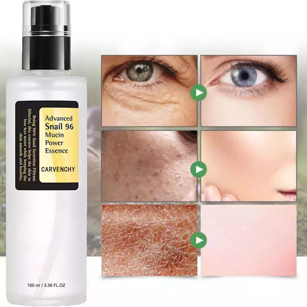 Advanced Snail 96 Mucin Power Essence 100ml, Snail Secretion Filtrate 96.3%, for Anti-aging & Nourishing, Wrinkle Improvement