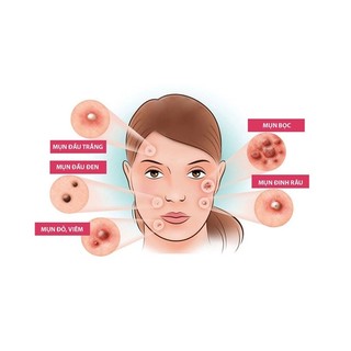 KEM MỤN ETE ACNE - MKII COSMETICS 15g