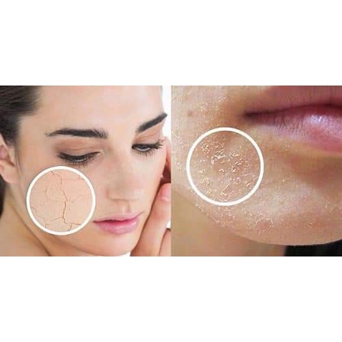 Kem Dưỡng Đa Chức Năng La Roche Posay Cicaplast B5 - Mypham_lavi