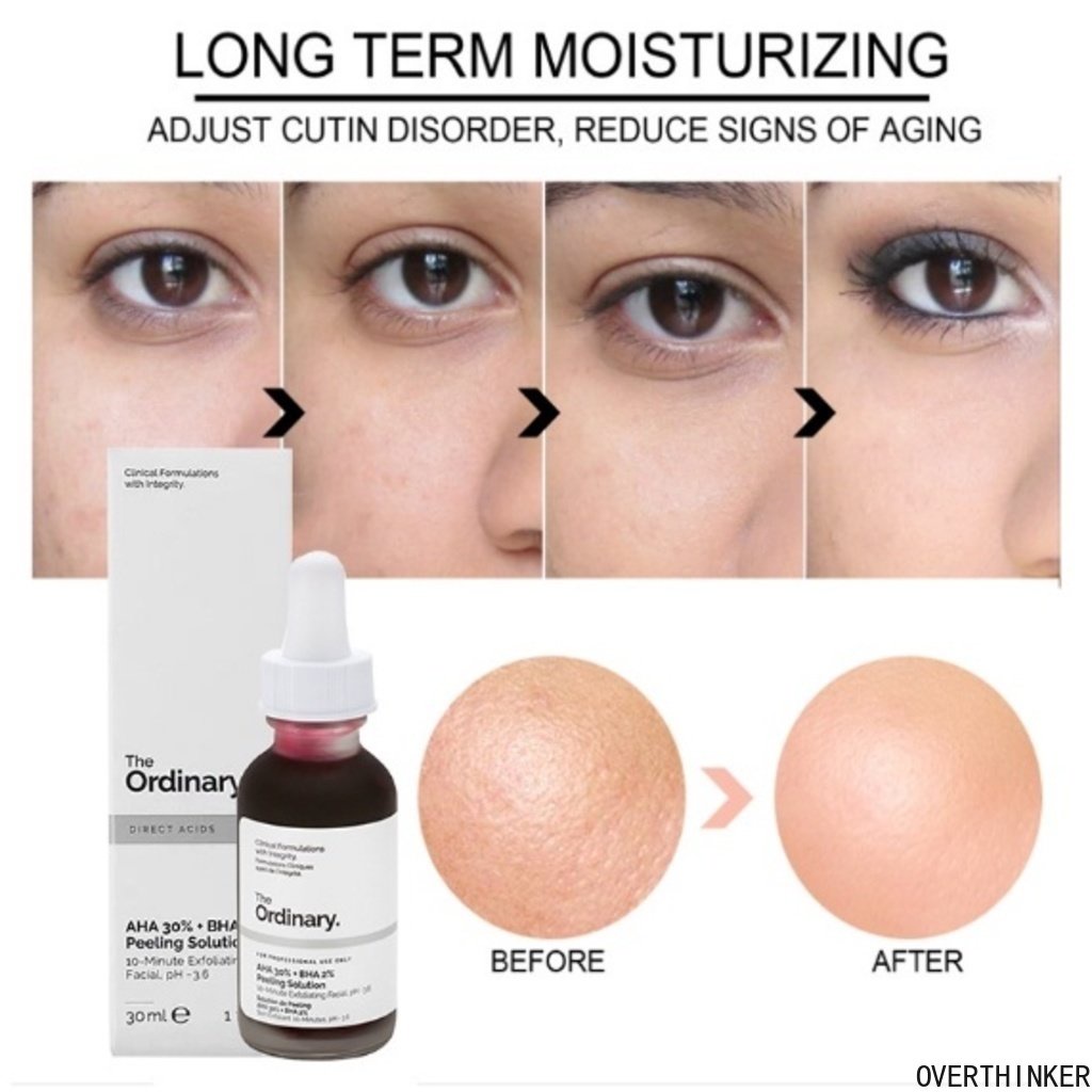 THE ORDINARY Hàng Có Sẵn Axit Salicylic 30% AH-A + B-HA 2% Chính Hãng Tinh Chất Tẩy Tế Bào Chết Toàn Thân 30ML