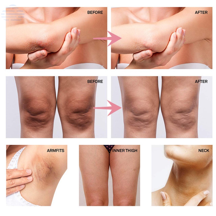 Kem làm trắng vùng da dưới cánh tay / đầu gối / toàn thân 50ml