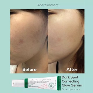 AXIS-Y Dark Spot Correcting Glow Serum 50ml [Skincare, Whitening, Dark Spots, Acne scars, Face]