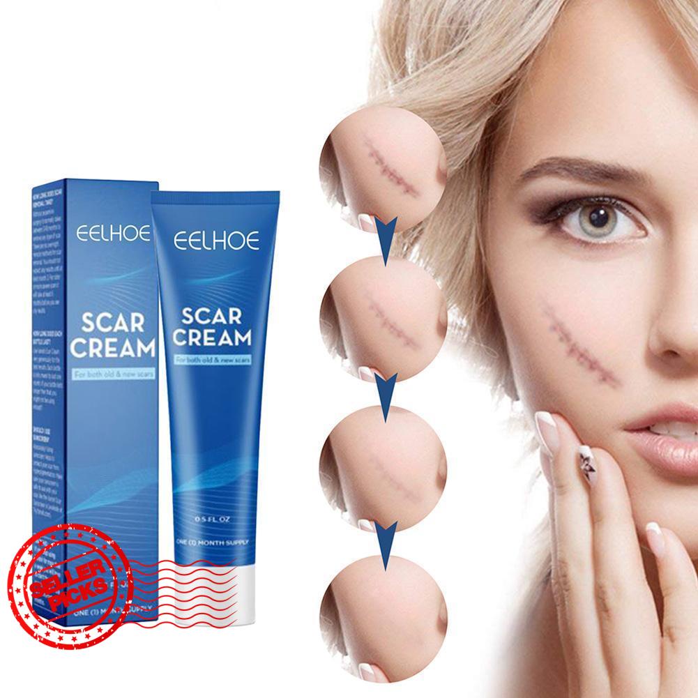 Kem Hỗ trợ giảm sẹo 15g I5Z1 Giúp Phục Hồi Da Hiệu Quả