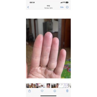 Kem dưỡng ch.ống nẻ Glysolid 100ml Đức