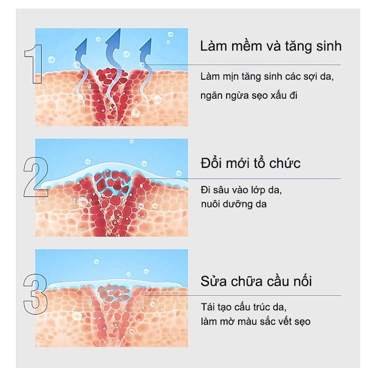 Kem xóa sẹo MOOYAM Scar removing cream 30g Trị sẹo lõm trị sẹo lâu năm