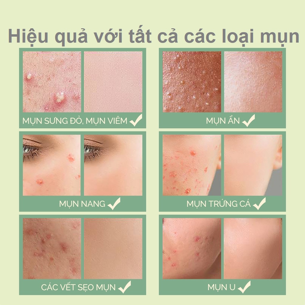 Serum Giảm Mụn Mờ Thâm AC SEBUM AMPOULE Mediworld