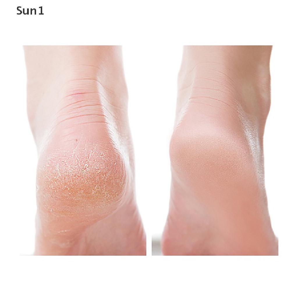 Bộ 2 Cây Dũa Móng Chân Loại Bỏ Tế Bào Chết Bằng Nano Tiện Dụng