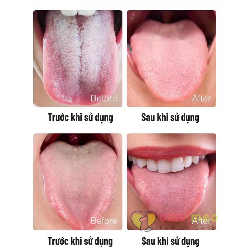 Gel vệ sinh lưỡi Aoba Nhật Bản, vệ sinh lưỡi sạch mảng bám, hơi thở hơm mát với hương bạc hà và hương đào tuýp 52g