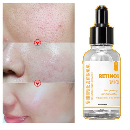 Serum Shine Zyza Retinol X10 trẻ hoá, làm da căng bóng, mờ thâm sẹo 30ml