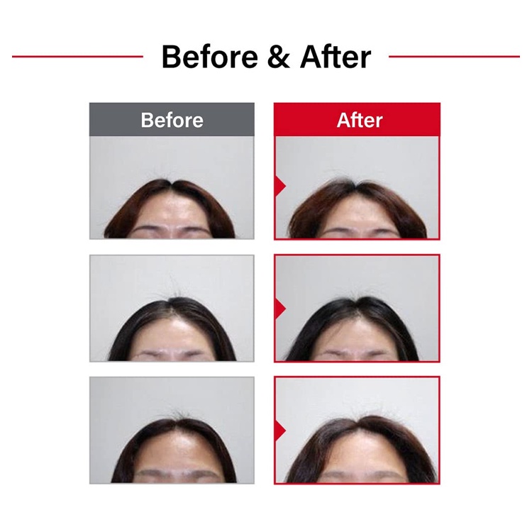 Dầu Gội Chăm Sóc Da Đầu 100ml