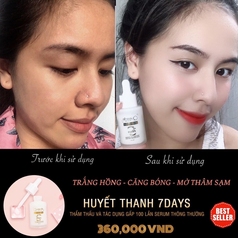 Huyết thanh trắng da 7 days