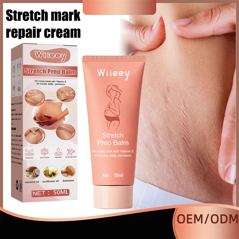 ♕Wiieey Dầu Dừa Kem Phục Hồi Vết Thai Sau Sinh Kem Dưỡng Làm Săn Chắc Chống Lão Hóa Cho Bà Bầu Béo Phì Làm Mờ Vết Rạn Da 50Ml Wfuture♕