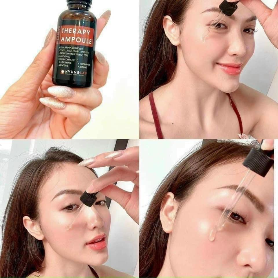 Serum Tế Bào Gốc Kyung Lab Chính Hãng PDRN Therapy Ampoule 30ml