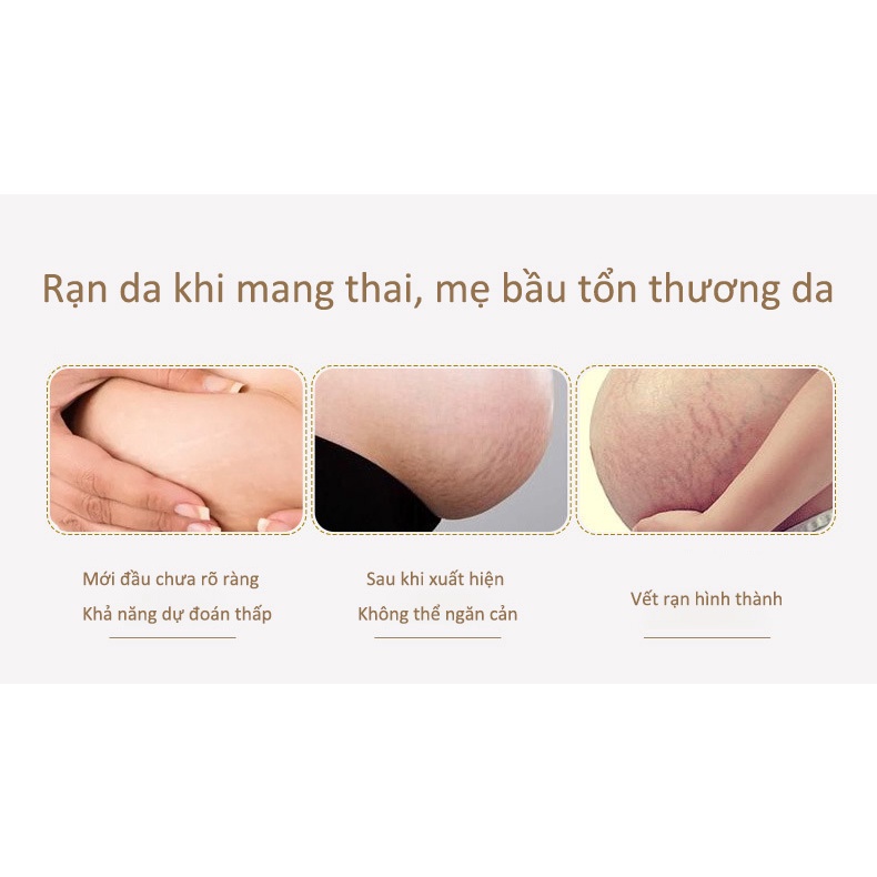 【💯Genuine Goods] QEM Stretch Marks Cream 100ml Prevention For Pregnant Women, Overcoming Stretch Marks