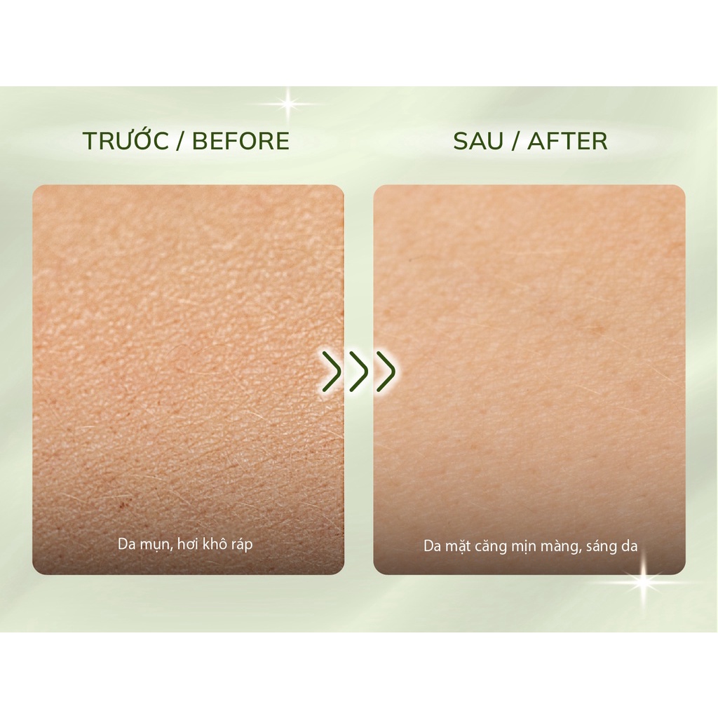 Nước hoa hồng tía tô Nhật Bản Perilla Natural Skin Lotion 500ml, toner tía tô cân bằng da, lotion cho da mụn