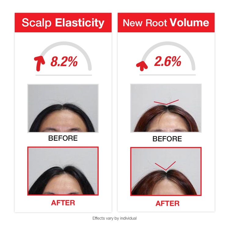 Folligen Plus Shampoo 500ml