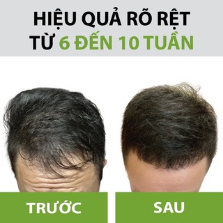 Xịt Dưỡng Tóc Hoa Đà