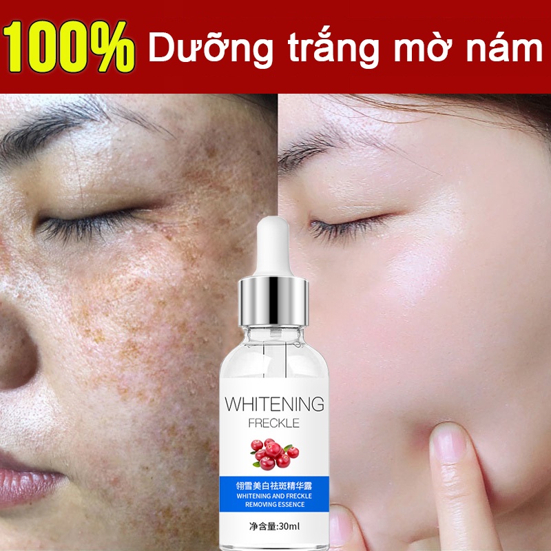 Kem loại bỏ nám trắng da tinh chất vitamin C kem dưỡng trắng da collagen tinh chất làm trắng da hiệu quả loại