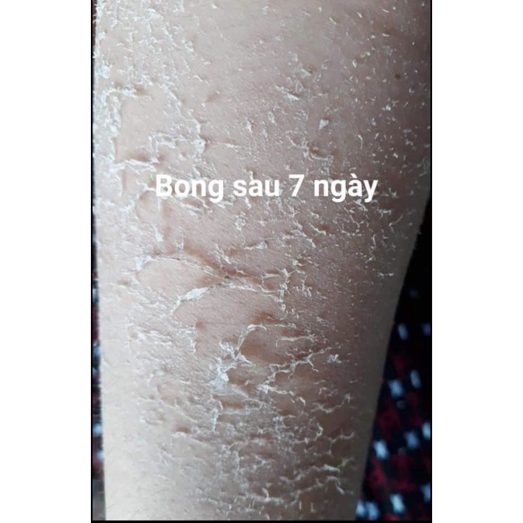 Kem Body Bong Da -  Tái Tạo Da Trắng Sáng dành cho da ngâm da đen chai lì, da không ăn kem, da thâm sạm