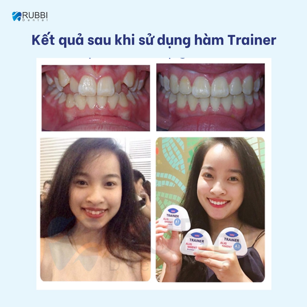 Niềng răng trong suốt niềng răng tại nhà chính hãng TRAINER - Bộ chỉnh nha dành cho người lớn và trẻ em A1 + A2 + A3 | BigBuy360 - bigbuy360.vn