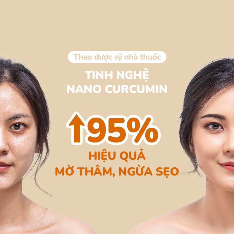 Gel Nghệ Giảm Mụn, Mờ Thâm Nano Curcumin Mờ Sẹo, Không Gây Vàng Da Dành Cho Da Dầu Mụn NEOSKIN 20gr