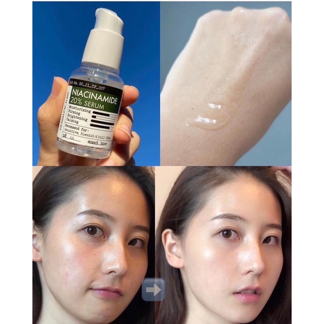 Tinh chất dưỡng sáng mờ thâm Derma Factory Niacinamide 20%