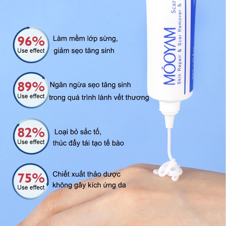 Kem xóa sẹo MOOYAM Scar removing cream 30g Trị sẹo lõm trị sẹo lâu năm