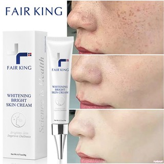 ♕fair king kem trị tàn nhang kem làm mờ vết thâm kem làm trắng da làm mờ vết thâm kem mặt chống nhăn loại bỏ vết thâm 20g upbest