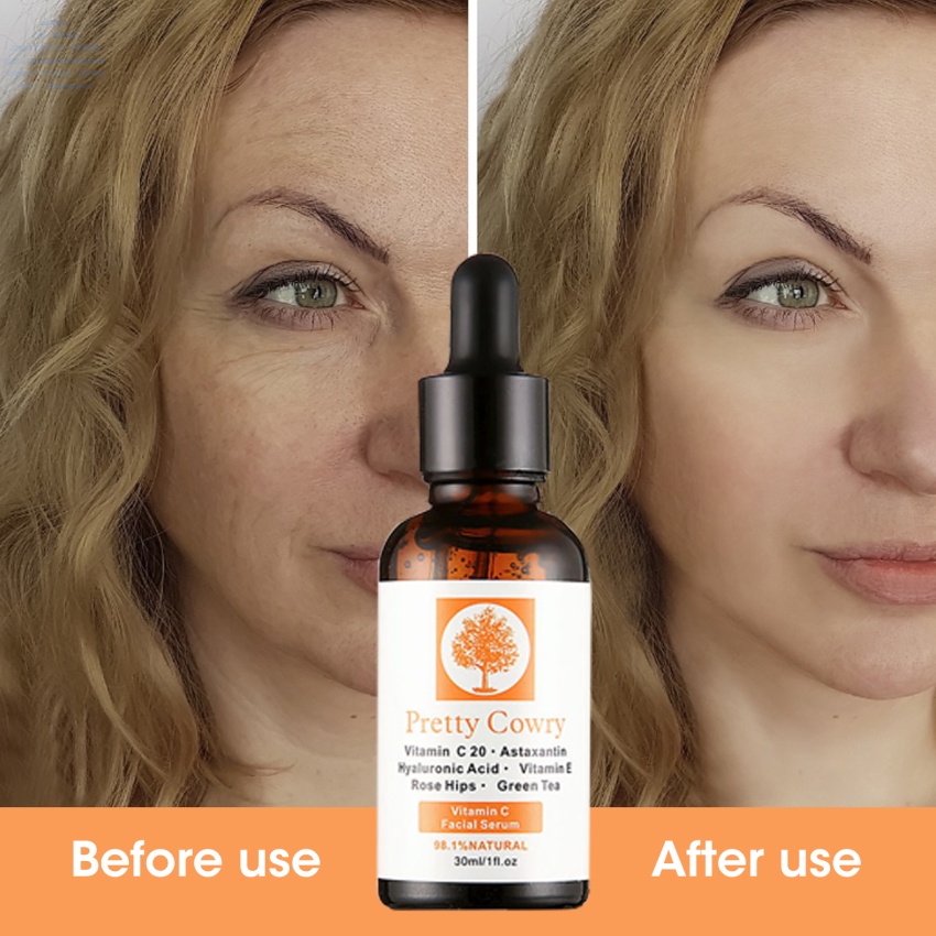 Serum vitamin C nguyên chất 100% hyaluronic acid chống lão hóa và nếp nhăn làm săn chắc da mặt
