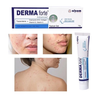 Kem dưỡng giảm mụn và thâm mụn Derma Forte 15g