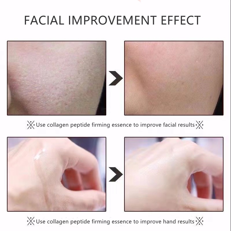 Tinh Chất Collagen Peptides HANKEY 30ml Chống Lão Hóa / Nếp Nhăn Làm Săn Chắc Da Mặt Và Se Khít Lỗ Chân Lông