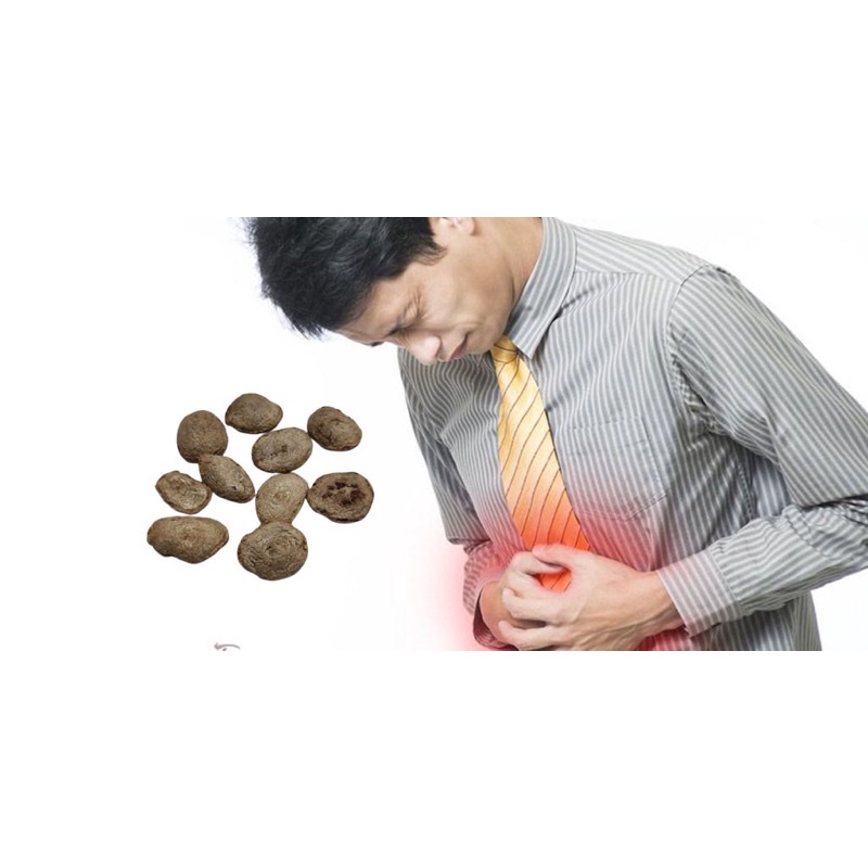 Hạt Sành Hay Còn Gọi Là Hạt Sang